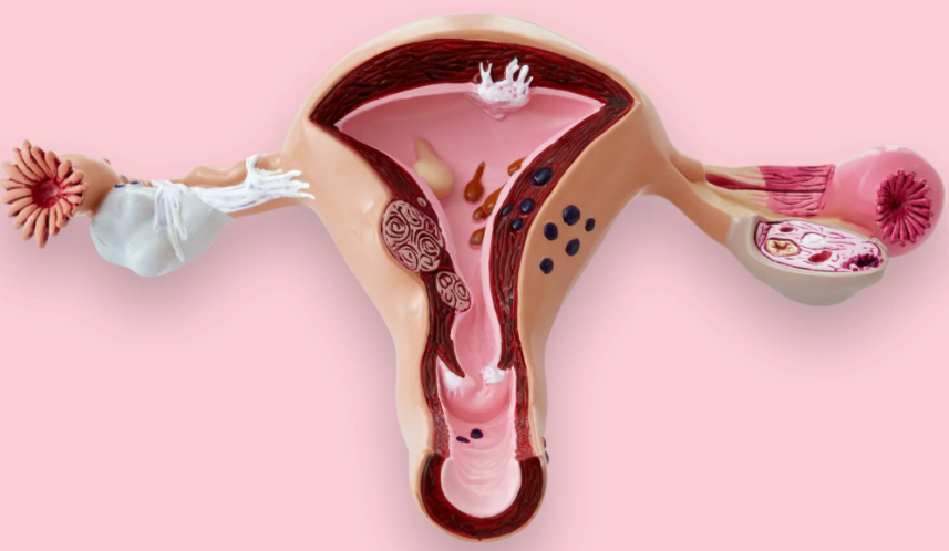 Nach gebärmutterentfernung regelblutung Frauenarztpraxis Dr.